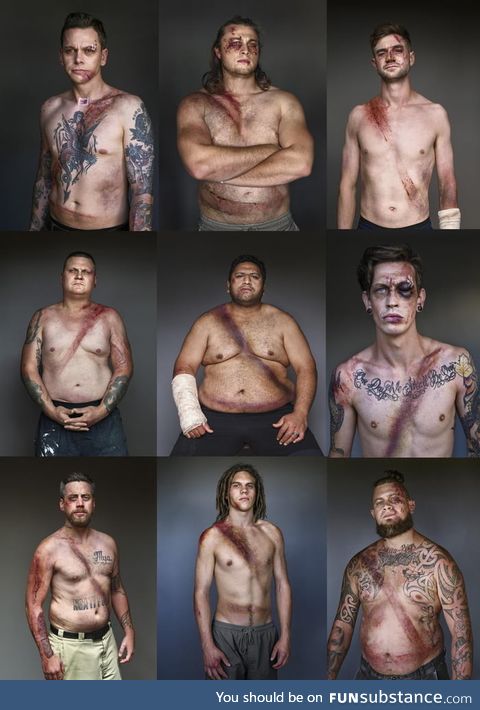 Car crash survivors showing the lifesaving effects of seatbelts