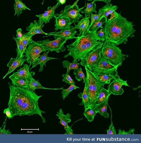 Image taken with a fluorescent microscope showing cell membranes (green), nucleus (blue),