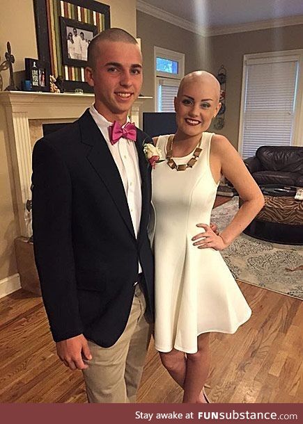 Teen Shaves head to match Homecoming date undergoing radiation