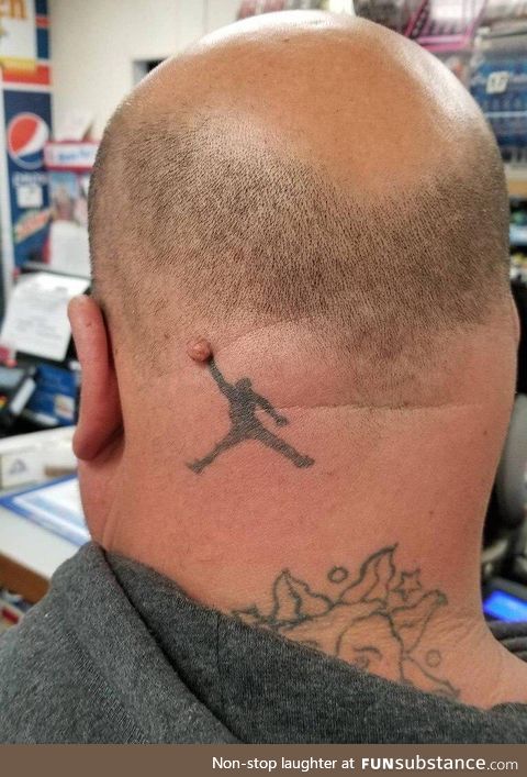 Hiding wart with a tatoo? Say no more