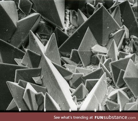 A kidney stone under an electron microscope