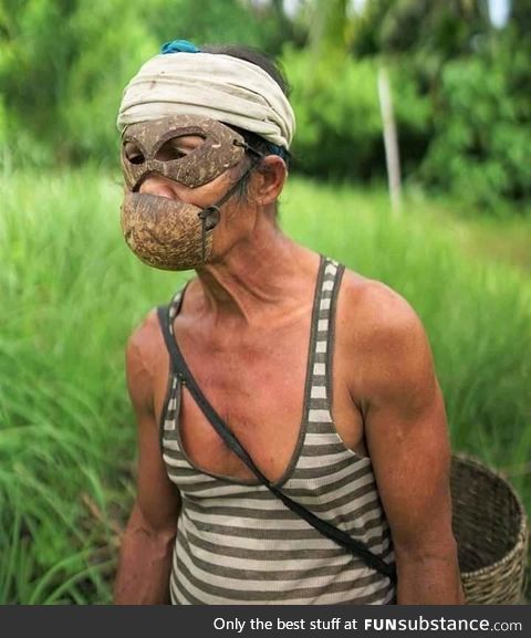 Coconut PPE in the Philippines