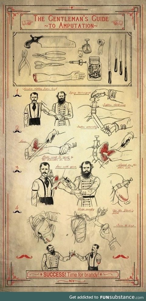 The gentleman’s guide to amputation