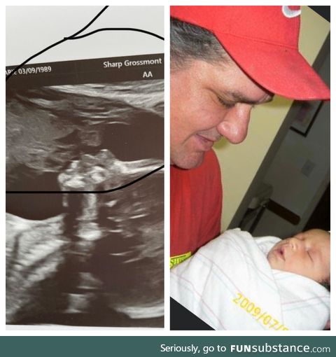 My late father decided to show up in my second child’s ultrasound