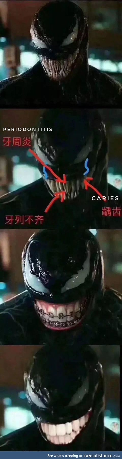 Venom needs to get his teeth fixed