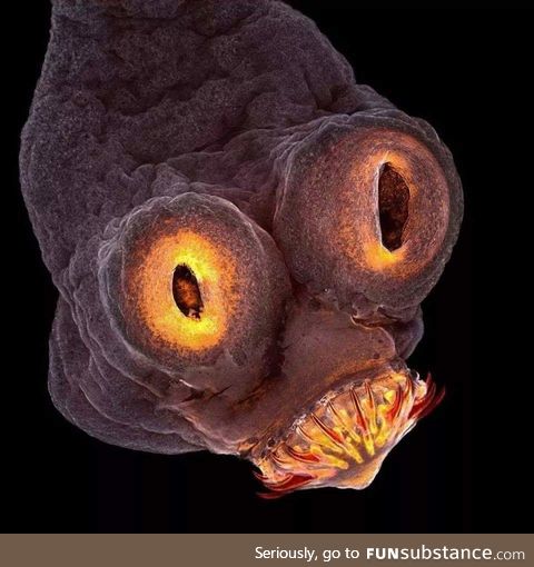 The head of a tapeworm