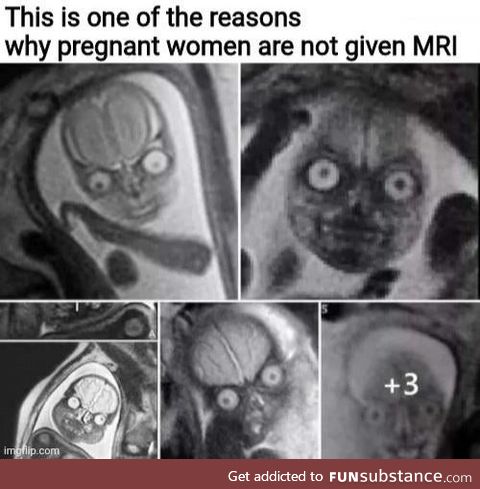 MRI reveal the demons inside us