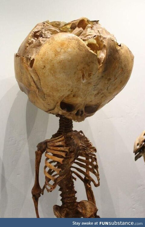 Replica skeleton of the average Rick and Morty fan