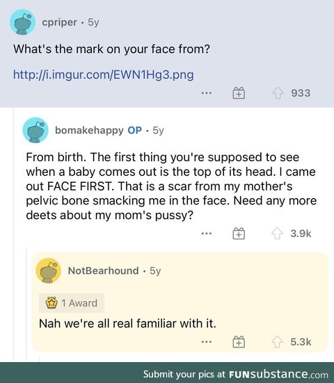 Was Googling why Bo Burnham had a mark on his face and found this gem of an exchange from