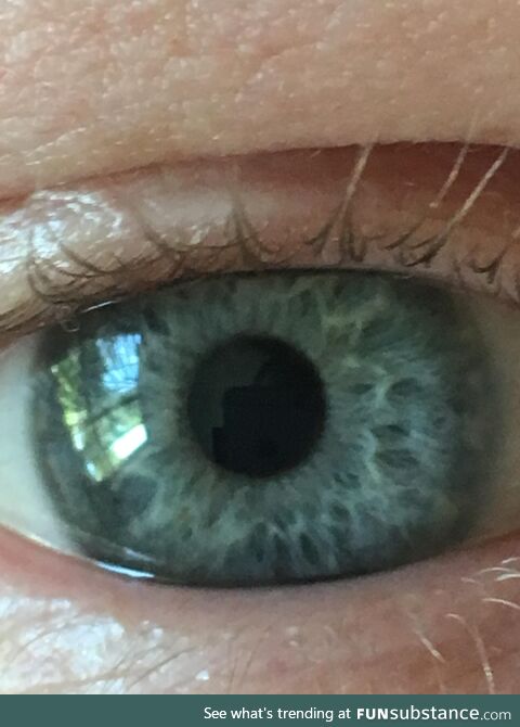 My eye has a screaming face in it