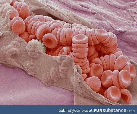 Ruptured venule under the scanning electron microscope