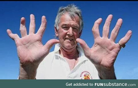 David Morrison's hands after playing as a wicketkeeper-batsman for 45 years