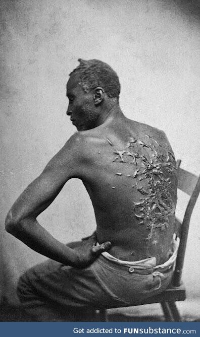 Photo of A Runaway Slave's Back, After Years of Whipping and Slave Violence