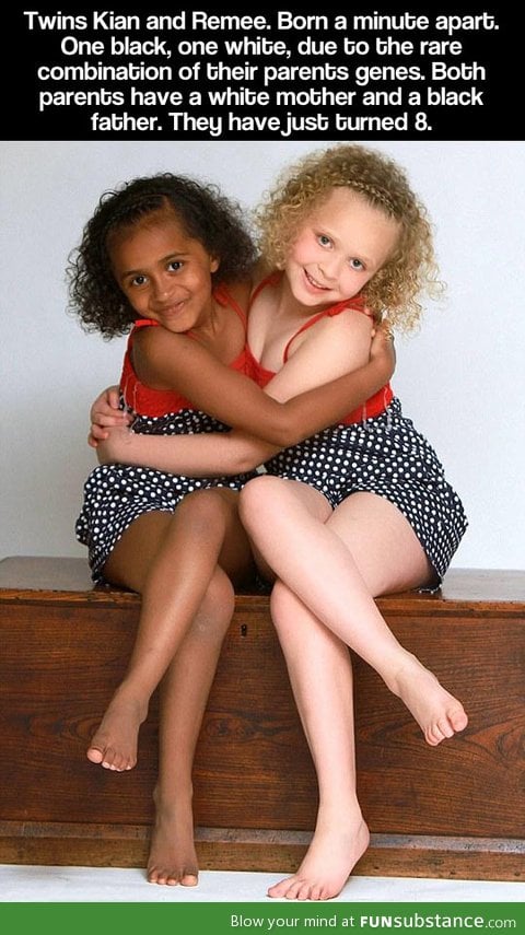 genetically they are both mixed races but look different