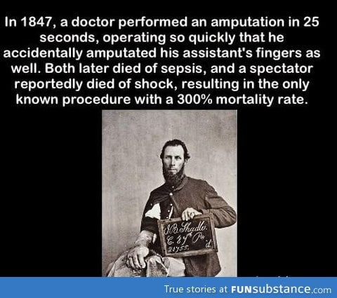 Robert Liston performed a operation with a 300% mortality rate