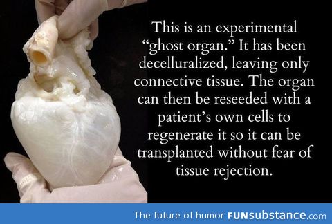 Did you hear we can 3D print organs now?