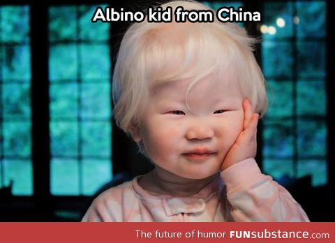 An albino kid from china